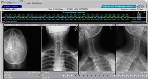 Viewing a study of a fictional patient on Greensboro Imaging's PACS.